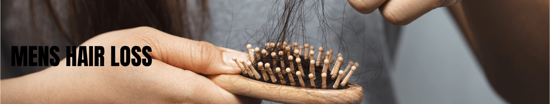 Mens Hair Loss - Brandlistry Nigeria