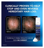 Regaine for Men Extra Strength Scalp Foam 5% w/w Cutaneous Foam - 1 months supply