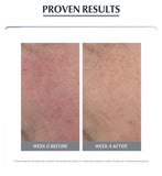 Eucerin Anti-Redness Concealing Day Cream SPF30 (Tinted) 50ml