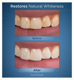 Waterpik Whitening Water Flosser WF-06UK