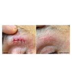 Kelo-Cote Scar gel - 6g