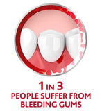 Corsodyl Complete Protection Gum Care Toothpaste Whitening 75ml