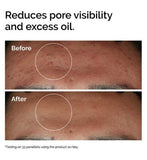 The Ordinary Niacinamide 10% + Zinc 1% Oil Control Serum - 30ml