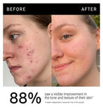 The INKEY List™ 15% Vitamin C and EGF Serum 30ml