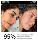 The INKEY List™ Succinic Acid Treatment 15ml