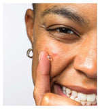 Garnier Pure Active SOS Anti-Blemish Stick 10ml