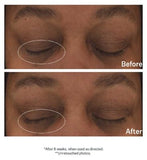 StriVectin Hyaluronic Tripeptide Gel-Cream for Eyes