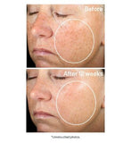 StriVectin Super-C Retinol Brightening & Correcting Serum