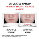 Neutrogena Clear and Defend+ Wash 200ml