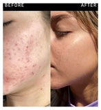 The INKEY List™ Niacinamide Serum 30ml