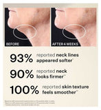 StriVectin Peptight Tightening Neck Serum Roller 50ml