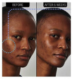 The INKEY List™ SuperSolutions 20% Niacinamide Serum 30ml