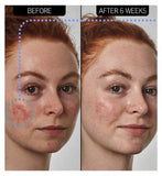 The INKEY List™ SuperSolutions 10% Azelaic Acid Serum 30ml