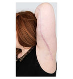 Kelo-Cote Scar Treatment with UV 15g