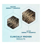 Head & Shoulders DERMAXPRO Scalp & Hair Revitaliser Shampoo 300ml