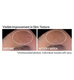 StriVectin Advanced Retinol Nightly Multi-Correct Serum