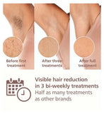 Philips Lumea 8000 Series, IPL Hair Removal Device with Pen Trimmer, 4 Attachments for Body, Face, Bikini & Underarms, BRI949/00