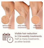 Philips Lumea 8000 Series, IPL Hair Removal Device, SenseIQ Technology, 2 Attachments for Body and Face, BRI945/00