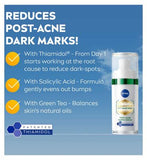 NIVEA Luminous 630 Post-Acne Marks Skin Perfecting Serum 30ml