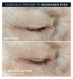 RoC Multi Correxion Hydrate + Plump Eye Cream with Caffeine and Hyaluronic Acid for Dark Circles and Puffy Eyes 15ml