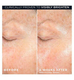 RoC Multi Correxion Revive + Glow Vitamin C Gel Cream, Skin Plumping and Brightening, 50ml