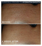 RoC Retinol Correxion Line Smoothing Max Hydration Cream, Intensive Anti-Wrinkle & Anti-Aging Moisturiser 50ml