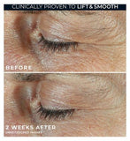 RoC Derm Correxion Dual Eye Cream, 2-in-1 Retinol Eye Duo for Eye Lift and Reduced Wrinkles 20ml