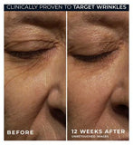 RoC Retinol Correxion Wrinkle Correct Night Cream for Smoother Skin & Reduced Wrinkles 30ml