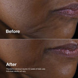 Clinique Smart Clinical Repair™ Lifting Face + Neck Cream 50ml