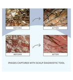 Briogeo Scalp Revival™ Charcoal + Tea Tree Scalp Treatment 30ml