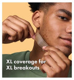 Hero Mighty Patch Surface Spot Patches, 10 Hydrocolloid Acne Patches