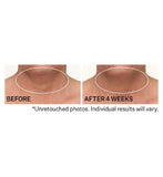 STRIVECTIN TL Advanced Tightening Neck Cream PLUS