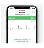 Alivecor KardiaMobile Single Lead ECG Monitor