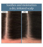 Briogeo Scalp Revival™ Rosemary Pre-Wash Oil for Hair and Scalp