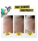 Kiehl's Truly Targeted Blemish-Clearing Solution 15ml