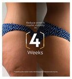 NIVEA Luminous 630 Anti Stretch Marks Body Oil-Serum 100ml