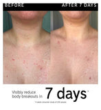 The INKEY List Glycolic Acid Exfoliating Body Stick