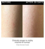 The INKEY List Glycolic Acid Exfoliating Body Stick