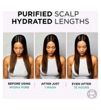 L’Oréal Paris Elvive Hydra Pure Scalp Serum, Shampoo & Conditioner Set for Oily Roots & Dehydrated Lengths