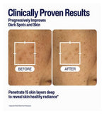 Cetaphil Healthy Radiance Brightening Serum with Niacinamide for Dark Spots, 30ml