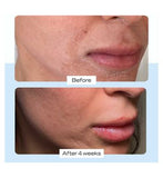 First Aid Beauty Ultra Repair Cream 56.7g