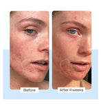 First Aid Beauty Ultra Repair Cream 56.7g