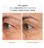 First Aid Beauty Retinol Eye Cream with Squalane + Ceramides 15ml