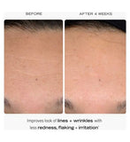 First Aid Beauty 0.3% Retinol Complex Serum with Peptides 30ml