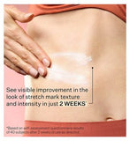 Strivectin SD Advanced PLUS Intensive Moisturizer