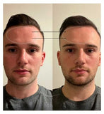 BEAUTYPRO PHOTON LED Light Therapy Facial Mask