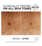 L'Oréal Paris Bright Reveal Bundle