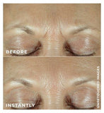 RoC Retinol DERM CORREXION® Fill+Treat Serum 15ml