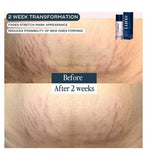 Luna Daily Motherhood The Skin Support Oil 100ml