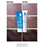 La Roche-Posay Effaclar Breakout Control 3-Step Trial Kit